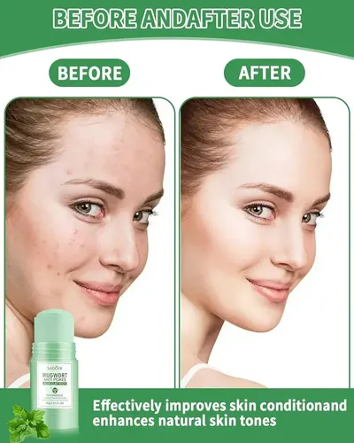 Mascarilla Facial En Barra Acne Te Verde Sadoer Anti Grasa