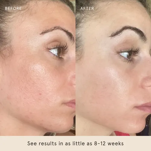 Sérum Bareface Liquid Gold Con 15% De Vitamina C, 1 Onza Líq