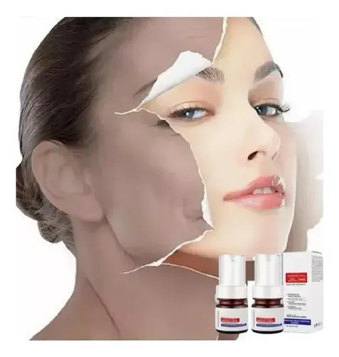 Whitening Y Freckle Eliminar La Esencia,aobenz