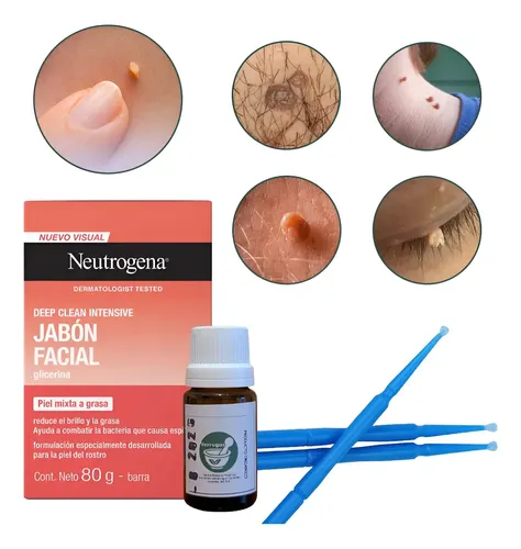 Extracto Secante De Verrugas Con Jabón Zona Genital Y Otras
