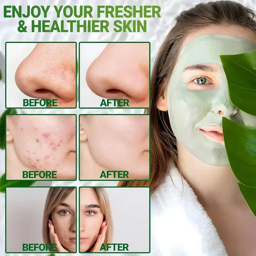 Mascarilla Facial En Barra Limpiadora Meidian Té Verde Todo Tipo De Piel