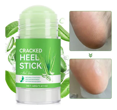 Crema Para Manos Y Pies, Crema Reparadora De Talones, Altame Aloe Vera