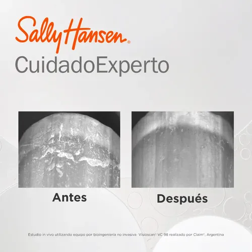 Tratamiento Fortalecedor de Uñas Sally Hansen Miracle Cure
