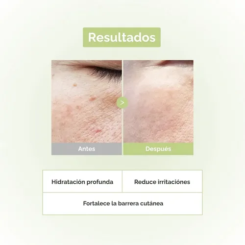Sérum Facial Cica Fermentada Antiacné Piel Sensible Inward