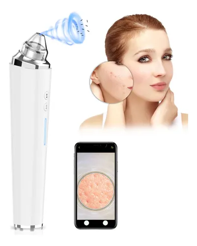 Aspiradora Eléctrica Blackhead Acne Rem