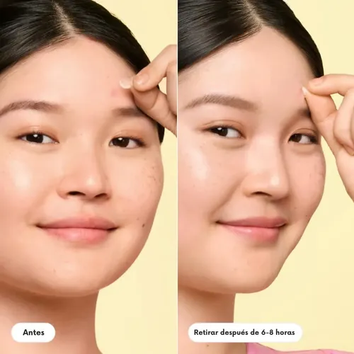 Parches Acne Elimina Granos Invisible Mighty Patch 30u