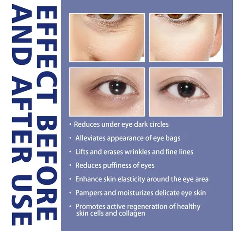 Suero Antiarrugas Ojos Con Complejo Peg-8 – Lifting