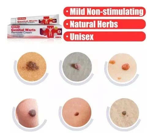 Cc 3uds*pomada Para Eliminar Las Verrugas Del Herpes