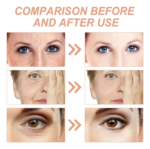 Crema Reafirmante Facial Hoygi Para Arrugas E Iluminar