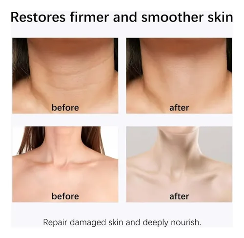 M* – Crema For El Cuello, Crema Reafirmante Antiedad *xl