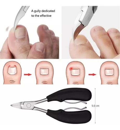 Xyl Cortaúñas Para Pies Gruesos, Podólogo, Uñas .