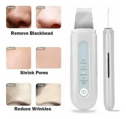 Scrubber, Ems, Eliminación Del Acné, Facial 3 Kit