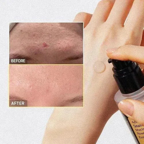 Nn Suero Cosrx Advanced Snail Mucin De 96 En Suero Power