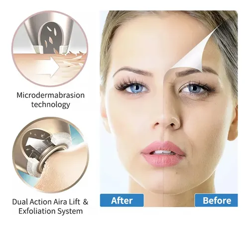 Máquina De Diamante Inalámbrica Blackhead Microdermabrasion
