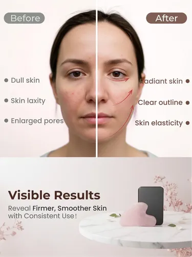 Techo Facial Gua Sha Para Herramientas, Color Rosa Jade, 8 X