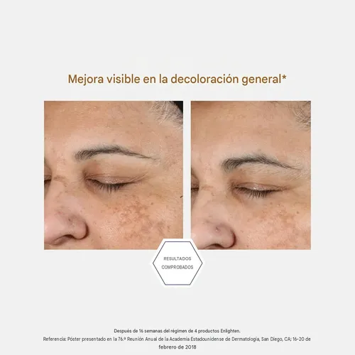 Neostrata Enlighten Pigment Controller Facial Despigmentante