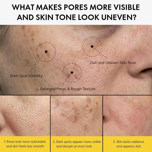 ‘crema Refinadora Eelhoe Poros+ Dark Spots With Arbutina