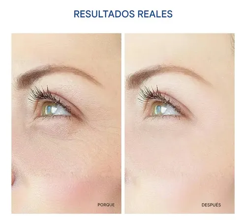 4 Parche Oculares De Microagujas Los Ojos Debajo Las Ojera