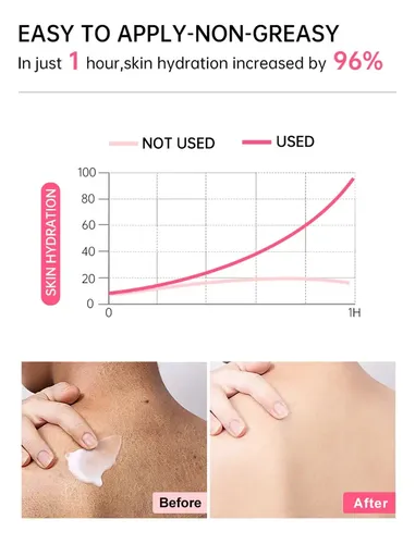Crema Reparadora Urea 25% Para Piel Seca Y Áspera Joypretty Fragancia Neutra