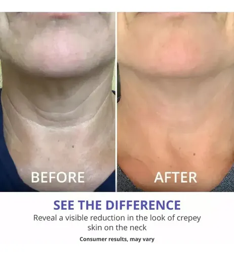 (vip) // Crema Reafirmante De Cuello Gopure 1pcs A