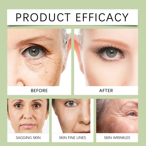 Tónico Facial Radiance Pads Con Forma De Caracol Para Líneas