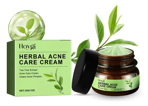 Crema Herbal Para El Acné Hoygi Para Una Piel Clara Y Suave