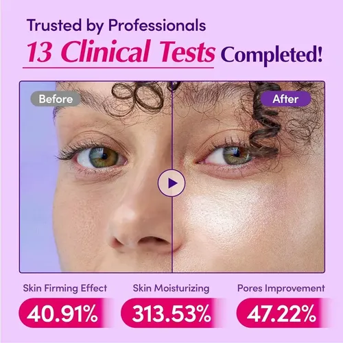 Yyds / A13 Sdfs Plumping 30ml Momento Día/noche Tipo De