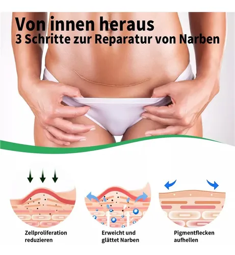 Hojas Silicona Para Eliminación Cicatrices Rollo Cinta Tiras