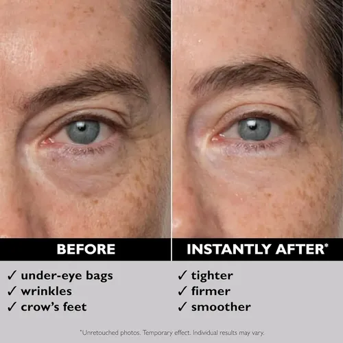 Peter Thomas Roth-tensor De Ojos Temporal/afirma Lineas Fina