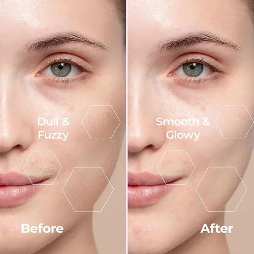 Depilador Facial Con Luz Led De Precisión Kradaa For Person