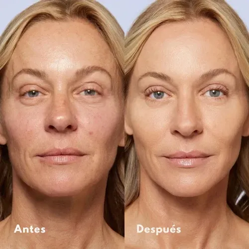 Base En Barra Ocheal Cobertura Natural