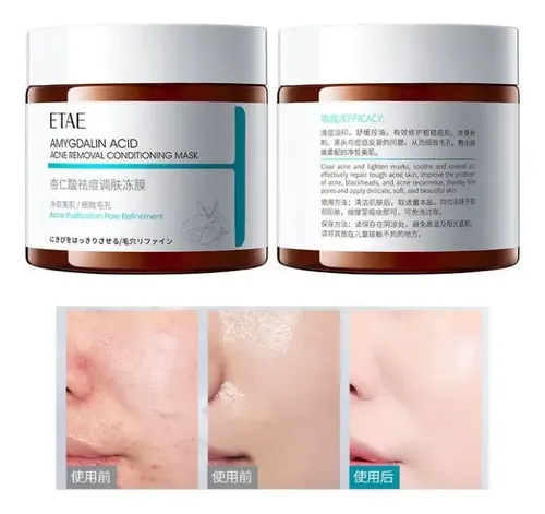 Máscara Facial Amygdalin Acid Acne Removal Etae 110g