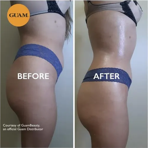 Envuelve Anticelulítico Guam Body Wrap Dren Plus 500g