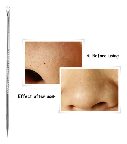 Juego De 1 Unidad, Blackhead Needles Ii, Eliminador De Comed