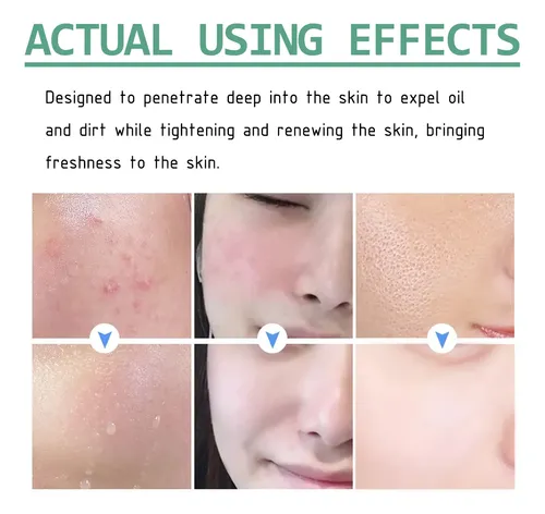 Hy/ Mascarilla Limpiadora De Arcilla De Té Verde Hoygi Para