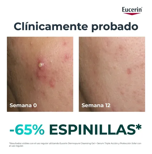 Eucerin Dermopure oil control serum triple efecto antibrillo tipo de piel grasa 40 ml