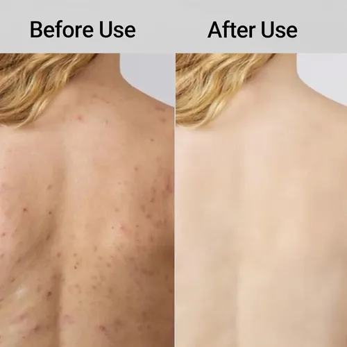 Toalla Exfoliante Blissal 2 En 1, Cuerpo Y Rostro, Rosa