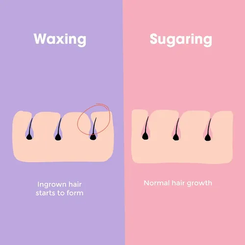 Pasta Azucaradora Para Bikini Brasileña Sugaring Nyc, Tamaño