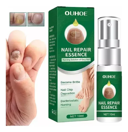 Suero Reparacion Uñas Ataca Hongos Onicomicosis 100% Calidad