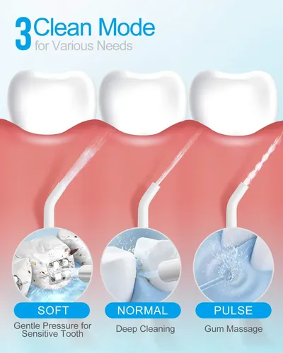 Hilo Dental Inalámbrico Nicefeel Fc159, 300 Ml, Portátil