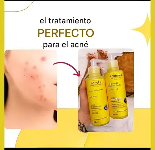 Kit Cuidado Facial Anti Acne Skincare Rhenuks Completo