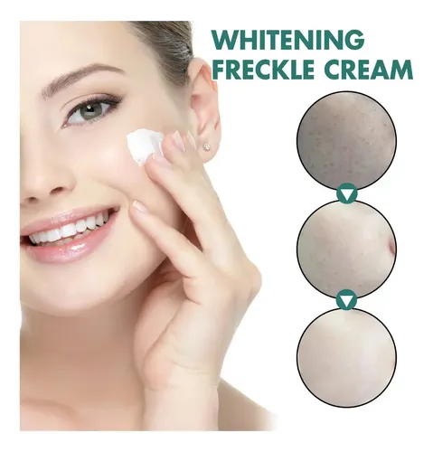 I Crema Iluminadora Facial Eelhoe Manchas Melasma Manchas Y