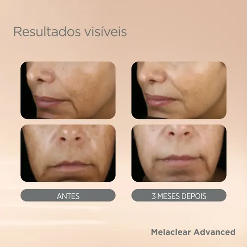 Sérum facial blanqueador antienvejecimiento ISDIN Refill Isdinceutics Melaclear Advanced, 30 ml