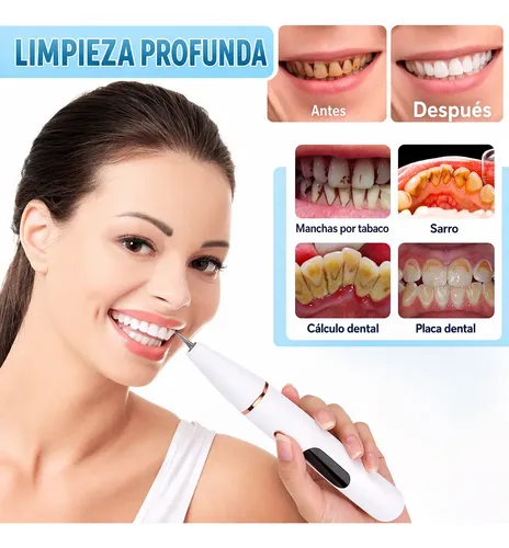 Removedor Cepillo Eléctrico Sónico Elimina Sarro Dental Oral