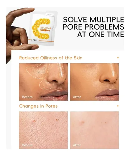 Máscara De Arcilla Con Vitamina C, Máscara Facial De Arcilla