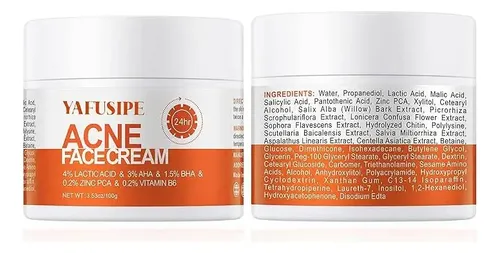 Dp10  Crema De Tratamiento Del Acné Para Espinillas, Puntos