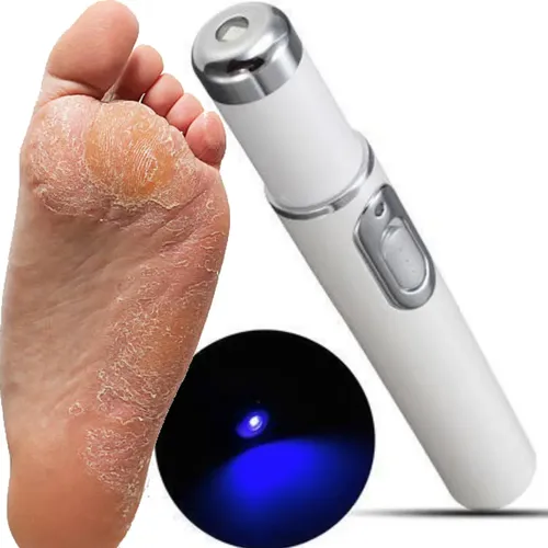 Laser Tratamiento Uñas Repara Onicomicosis Manos Pies Portab