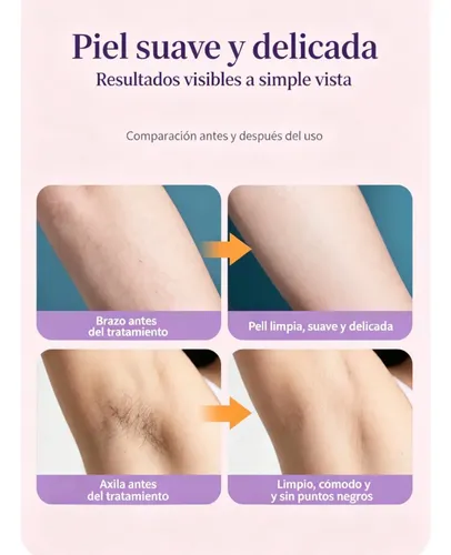 L Depiladora Inalambrica Mujeres Rasuradora Modelo Digital