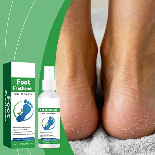 Spray For El Cuidado De Los Pies Con Aceite De Árbol Té