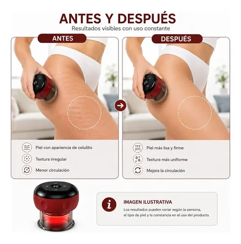 Masajeador De Succión Al Vacío Recargable Gua Sha